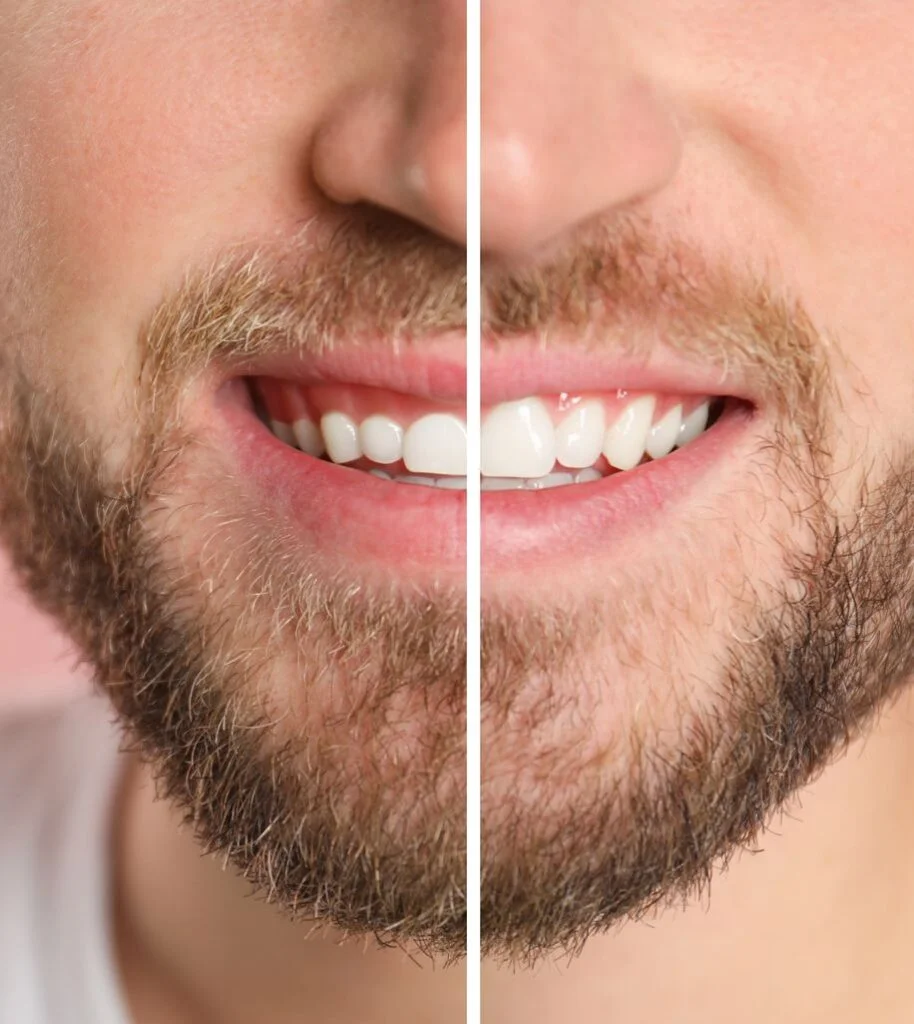 Dental Procedure
