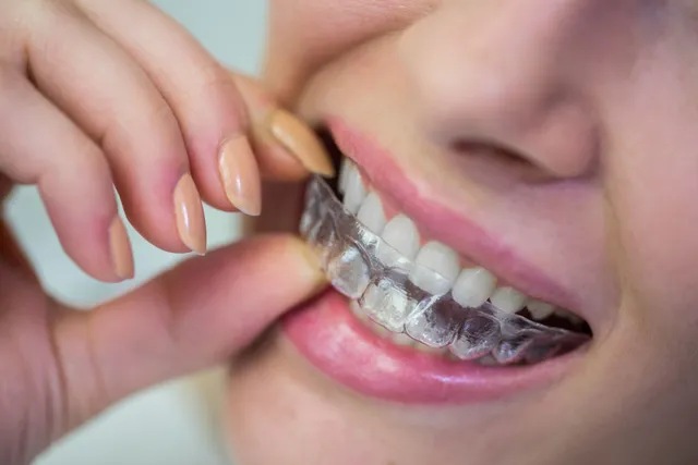 Dental Procedure