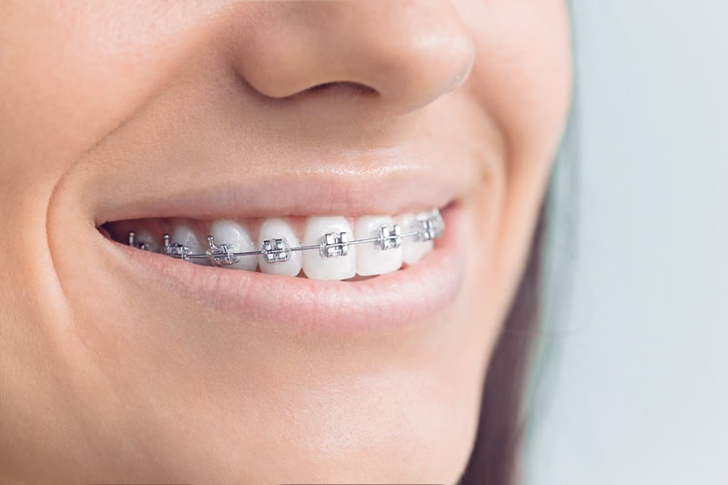 Dental Procedure
