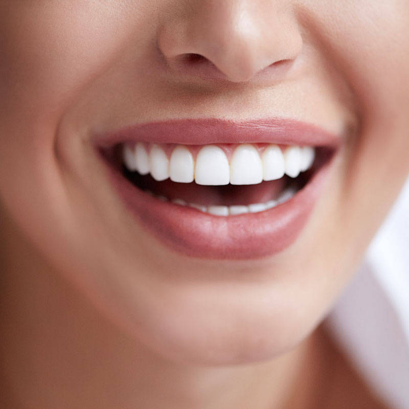 Dental Procedure
