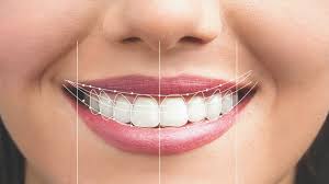 Dental Procedure