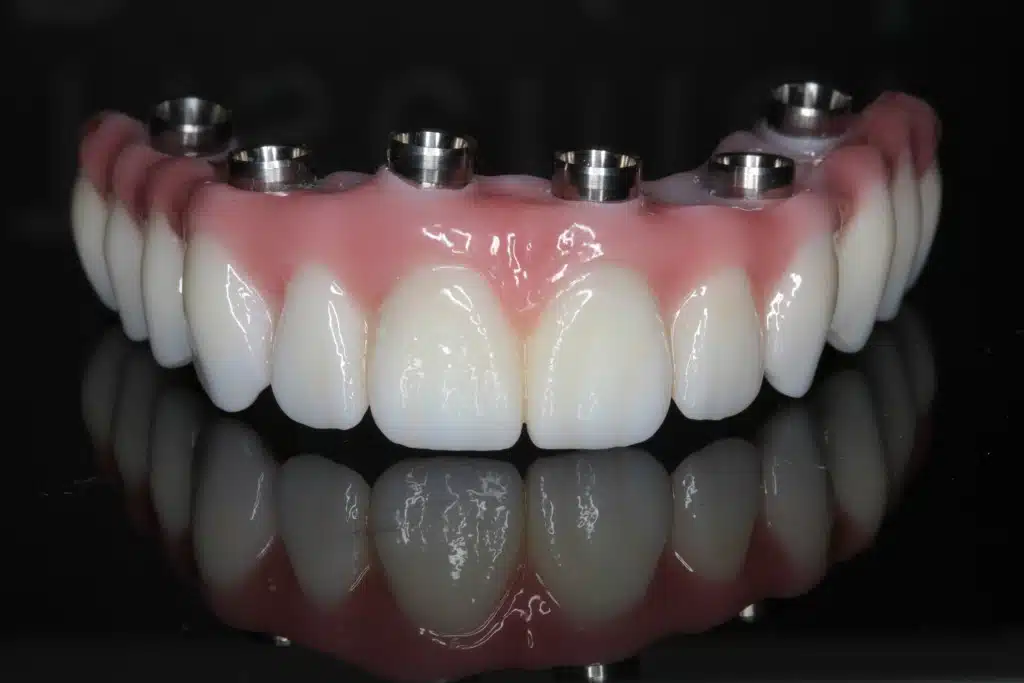 Dental Procedure