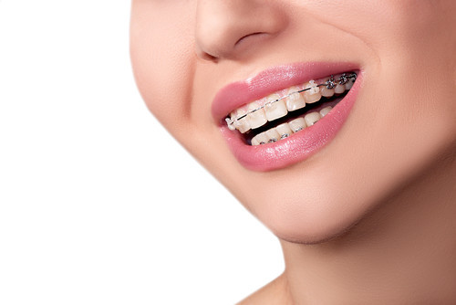 Dental Procedure